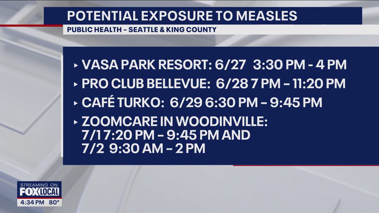Possible measles exposure in Bellevue, Seattle, Woodinville