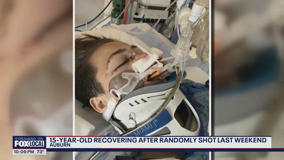 15-year-old recovering after 'random' shooting in Auburn