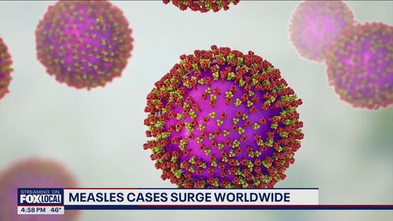 Measles cases surge worldwide