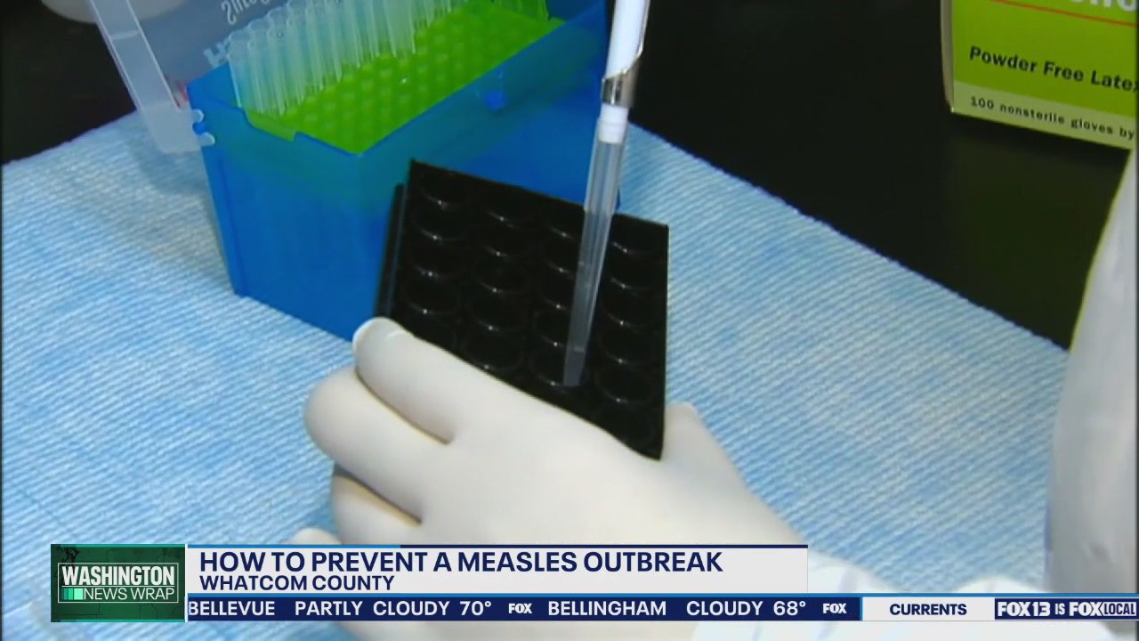 Preventing a measles outbreak in Washington