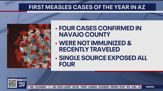 1st confirmed measles cases of year reported in Arizona
