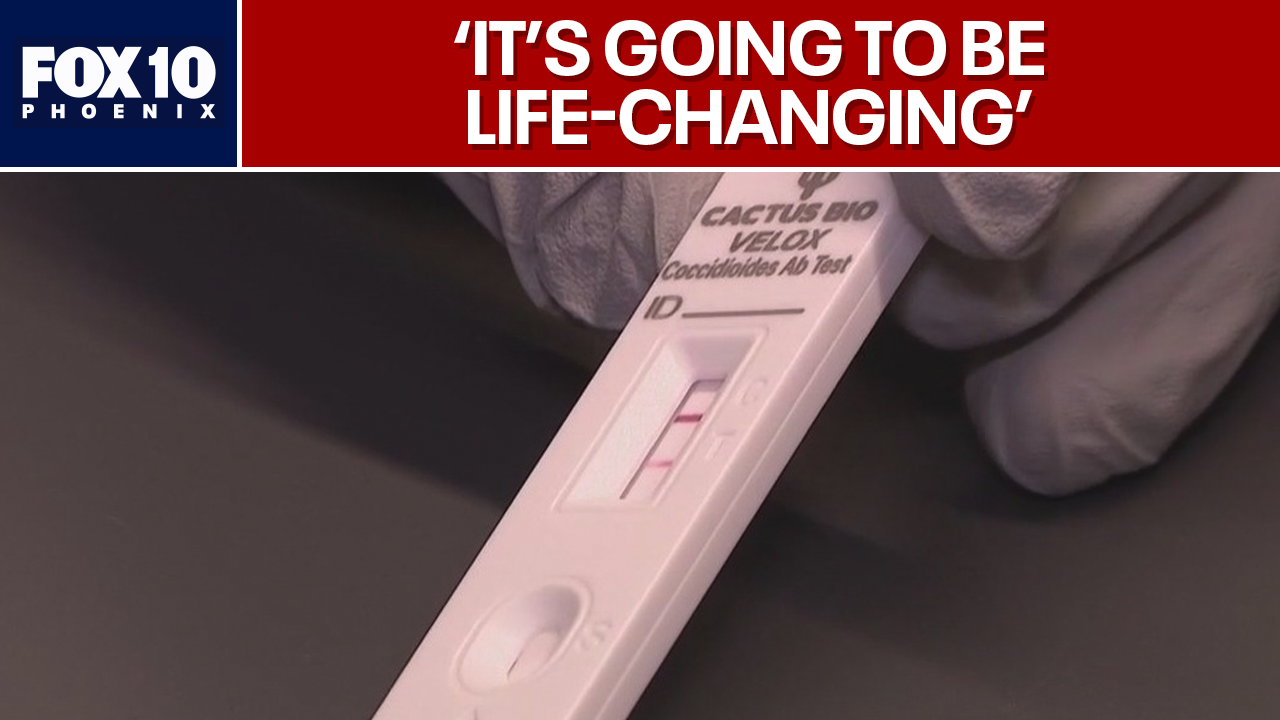 Mayo Clinic, ASU create new valley fever rapid test