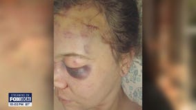 2 teens arrested in possible hate crime assault on WA transgender woman