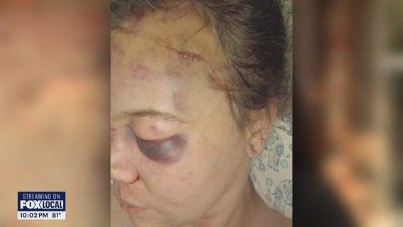 2 teens arrested in possible hate crime assault on WA transgender woman