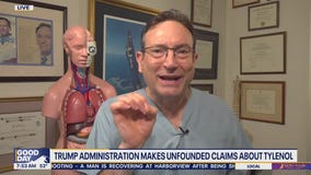 Trump administration makes claims about Tylenol and autism: Medical experts weigh in