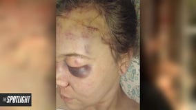 The Spotlight: Teens accused in hate crime assault