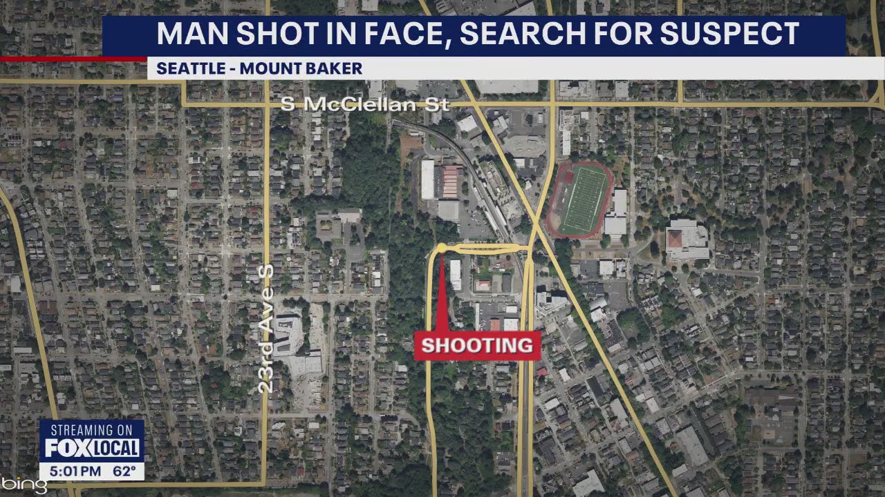 Seattle police searching for suspect after man shot in face