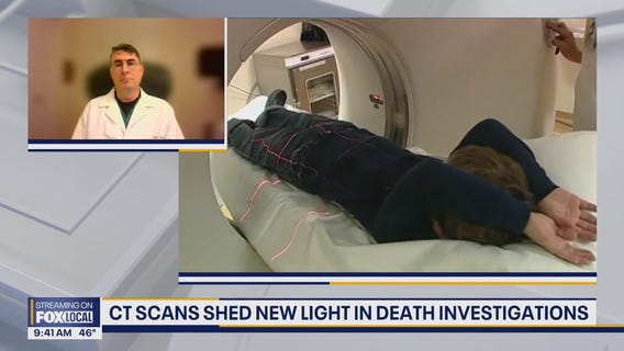 CT scans shed new light in death investigations