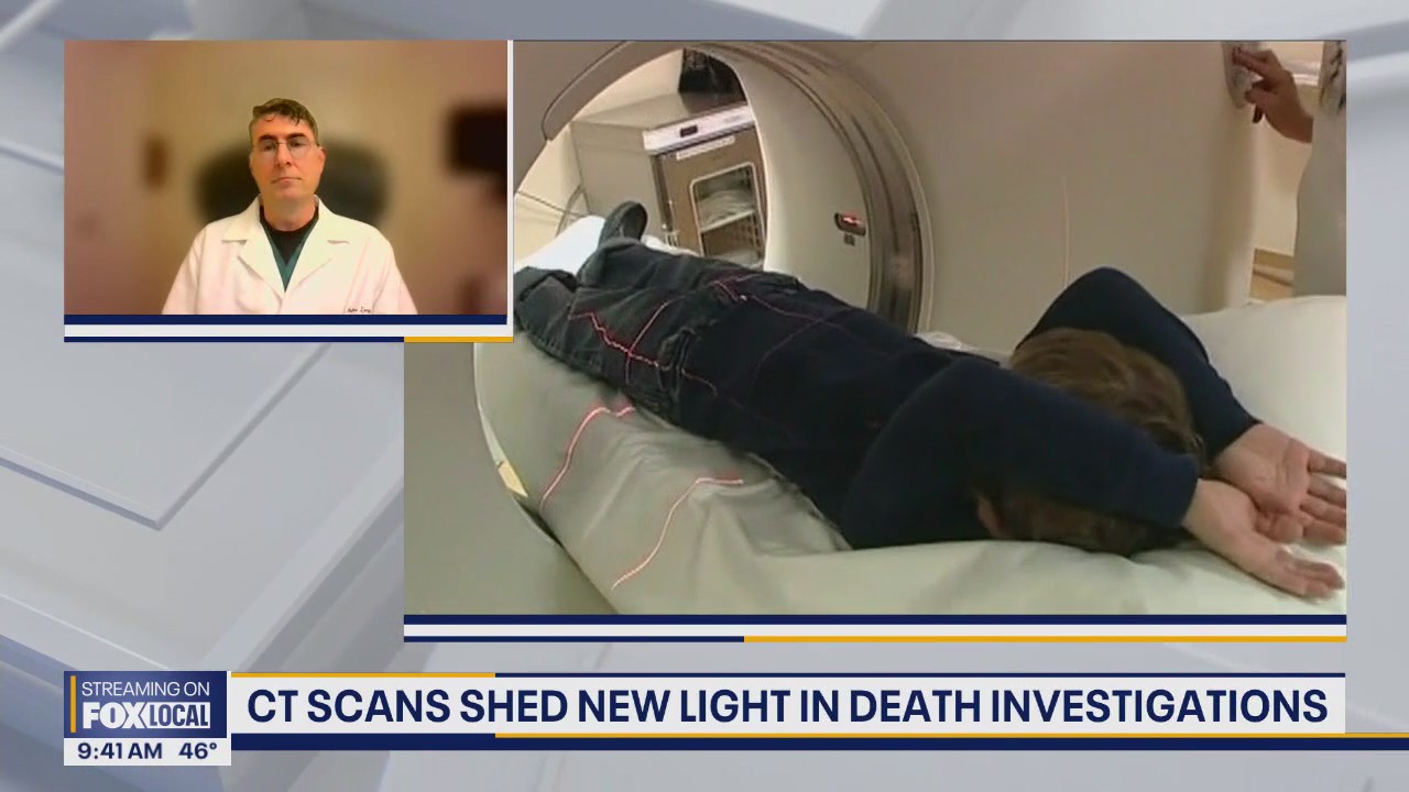 CT scans shed new light in death investigations