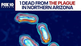 Person dies from the Plague in Northern Arizona