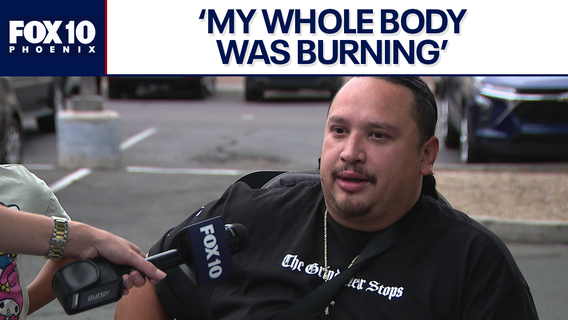 Tempe bee attack victim recounts what happened