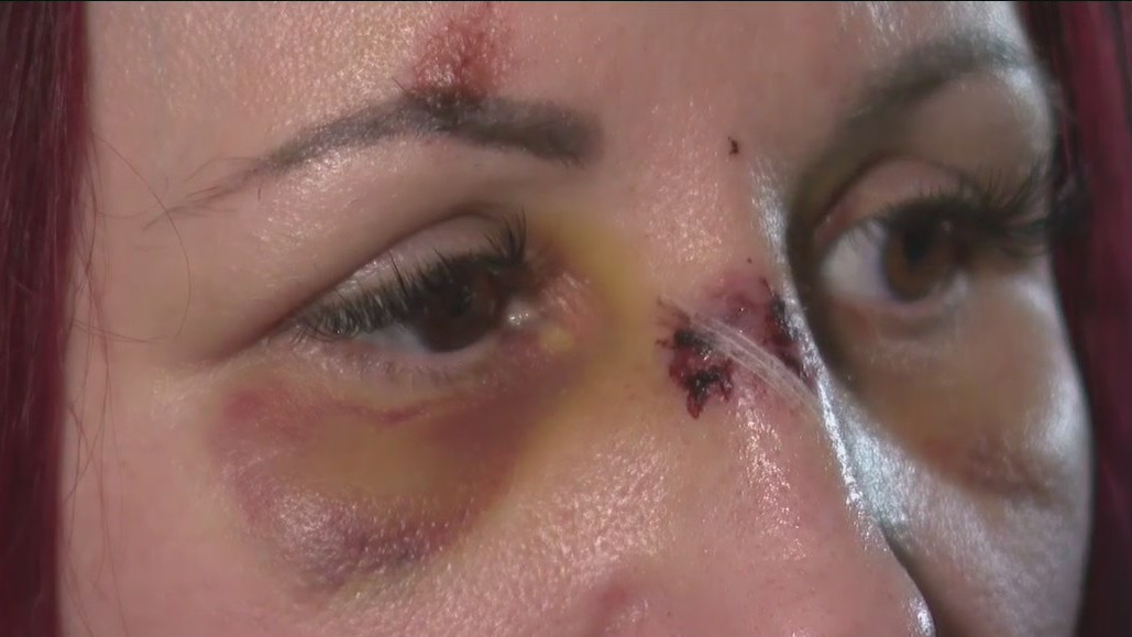 Woman injured after Summerfest Halsey concert