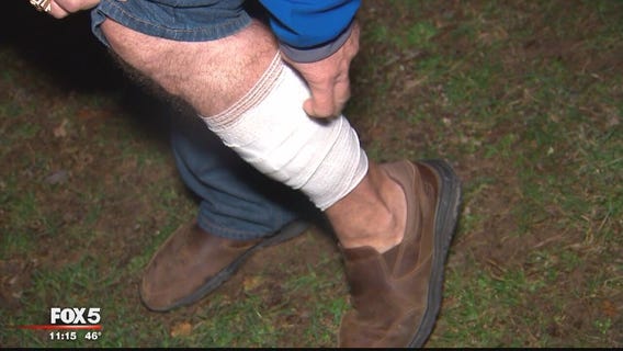 Man, pets attacked by fox in Fairfax County