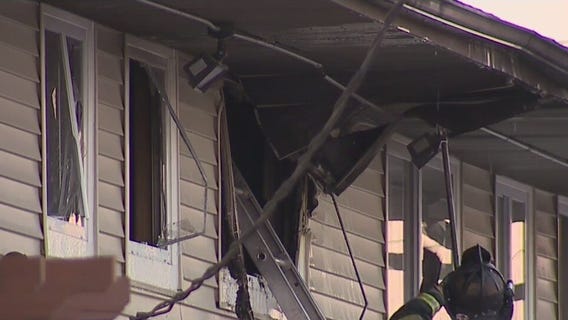Baby pulled from Milwaukee fire dies