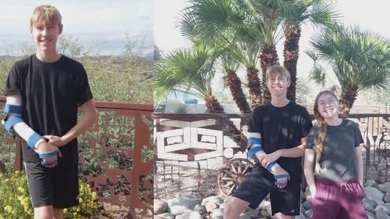 PCH surgeon gives insight into surgery for Globe teen who nearly lost arm after heroic act during flood