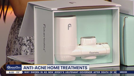 Anti-acne treatments you can do at home