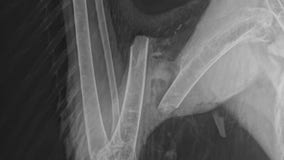 Franklin injured bald eagle shot, Wisconsin DNR believes