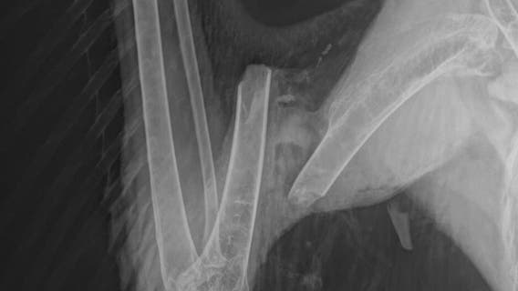 Franklin injured bald eagle shot, Wisconsin DNR believes