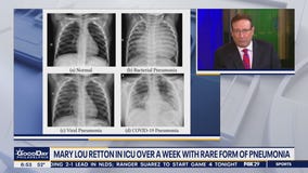 Health Watch: Former Olympian hospitalized with pneumonia