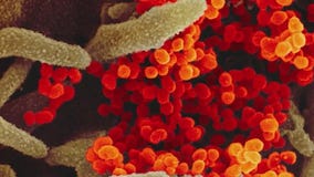 Another US agency assesses COVID-19 origin likely a Chinese 'lab leak': report