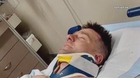 Milwaukee firefighter fell from roof, badly hurt, daughter's kidney failing