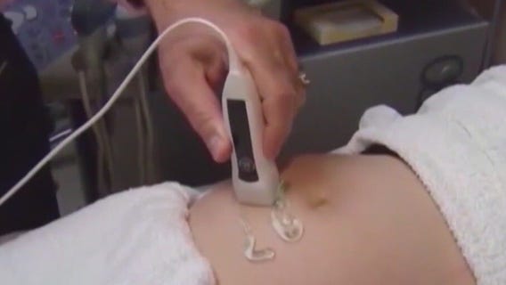 Wisconsin 1849 abortion ban challenge in court, activists weigh in