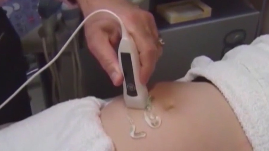 Wisconsin 1849 abortion ban challenge in court, activists weigh in