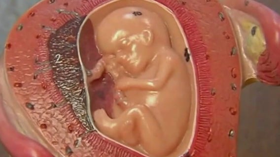 Wisconsin 1849 abortion ban challenge: What to know