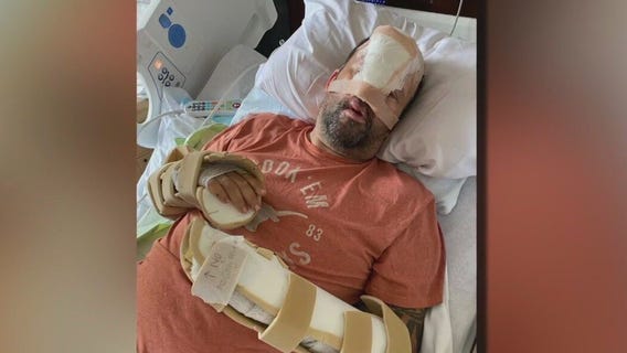 Walworth County chase, crash; deputy's life forever changed