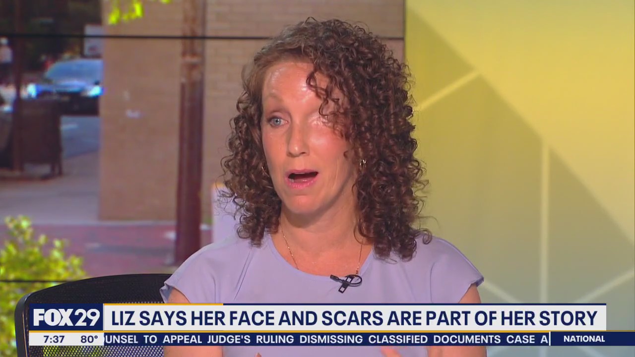 Disability Pride Month: celebration and conversation