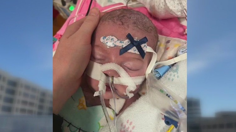 Oconomowoc newborn needs heart transplant
