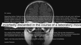 Children's Wisconsin 'profoundly sorry' for throwing out donated brain