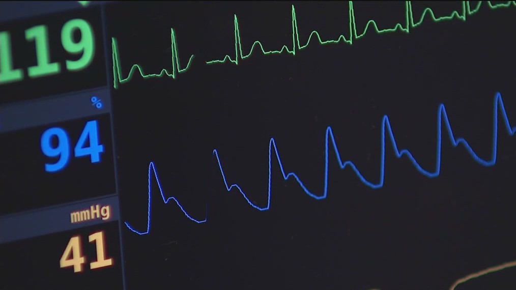 Project ADAM combatting sudden cardiac arrest