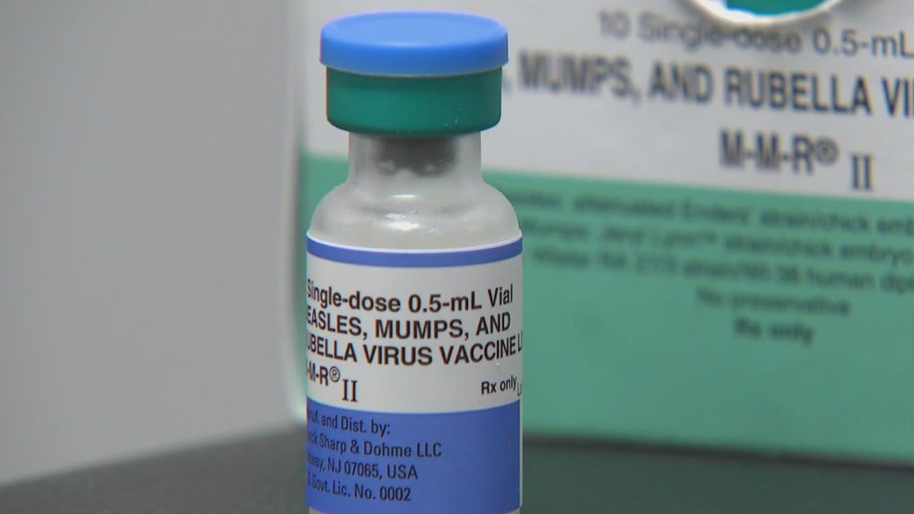 Update on measles cases in Wisconsin