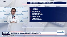 AdventHealth Orlando: What are the signs of a hernia?