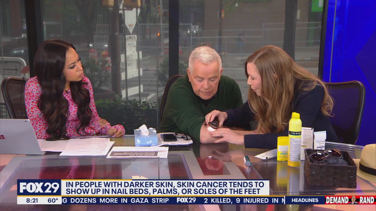 Doctor finds skin cancer spot on Mike Jerrick's arm