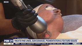 New 3-In-1 Laser Skin Resurfacing Tool