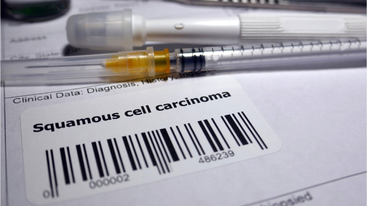 Study: Anal cancer cases and deaths are on the rise in the US