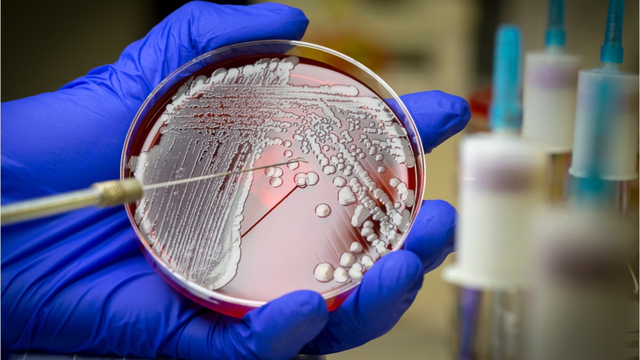 Study: Superbug MRSA can stay on household surfaces for months