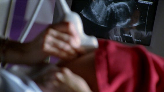 Small study finds injury to placenta in pregnant women with COVID-19