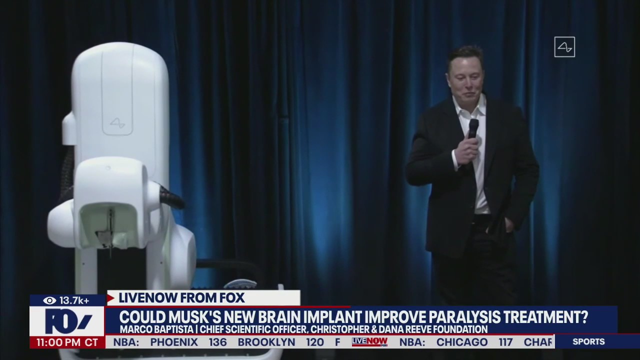 Can Neuralink chip improve paralysis treatment?