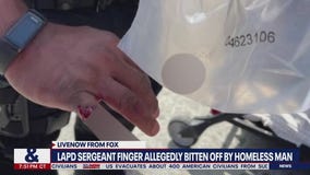 LA officer finger bitten off: Suspect charged with 'mayhem,' held on $100k bail | LiveNOW from FOX