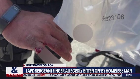 LA officer finger bitten off: Suspect charged with 'mayhem,' held on $100k bail | LiveNOW from FOX