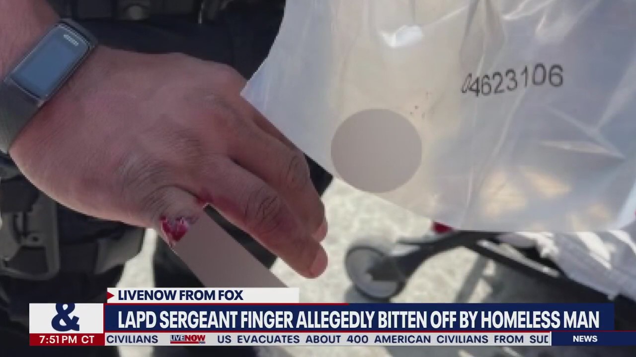 LA officer finger bitten off: Suspect charged with 'mayhem,' held on $100k bail | LiveNOW from FOX