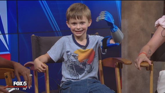 Maryland boy receives new 3D-printed prosthetic arm made at Home Depot