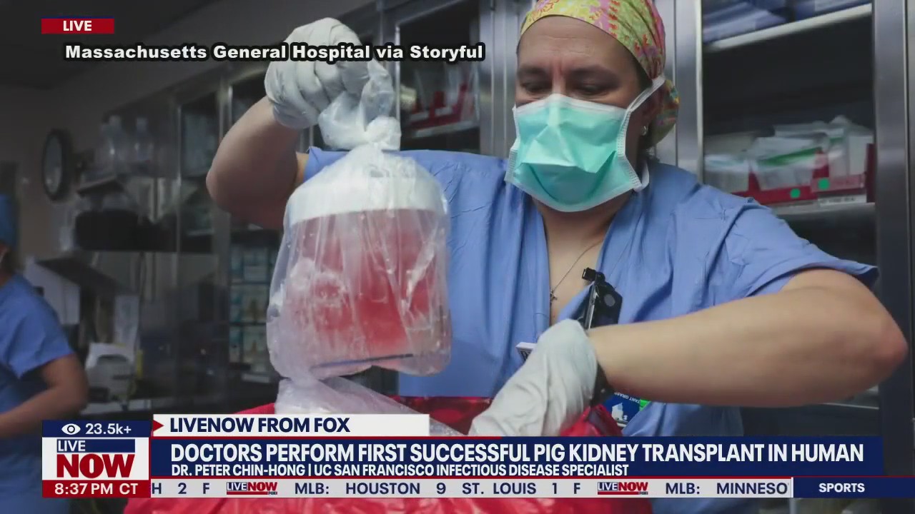 First pig kidney transplant in human