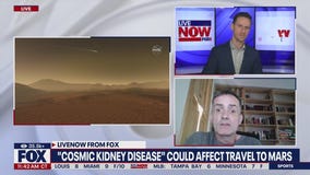 Cosmic Kidney Disease could affect travel to Mars