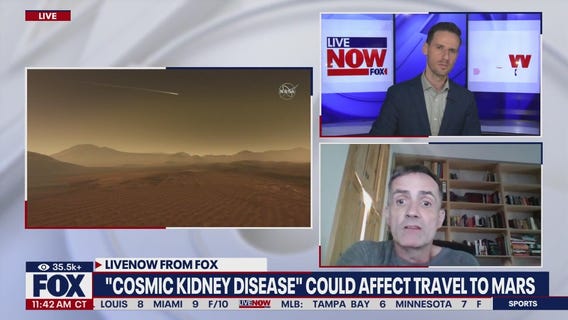 Cosmic Kidney Disease could affect travel to Mars