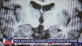 RFK Jr. says HHS will determine cause of autism