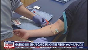 Gastrointestinal cancers on the rise